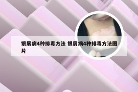 银屑病4种排毒方法 银屑病4种排毒方法图片