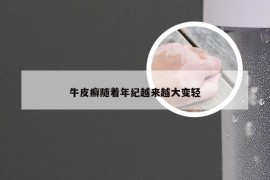 牛皮癣随着年纪越来越大变轻