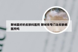 聊城最好的皮肤科医院 聊城有专门治皮肤病医院吗
