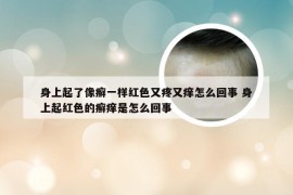 身上起了像癣一样红色又疼又痒怎么回事 身上起红色的癣痒是怎么回事