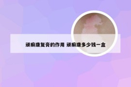 顽癣康复膏的作用 顽癣康多少钱一盒