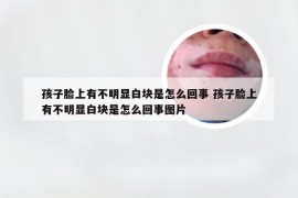 孩子脸上有不明显白块是怎么回事 孩子脸上有不明显白块是怎么回事图片