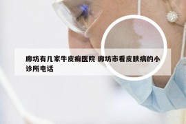 廊坊有几家牛皮癣医院 廊坊市看皮肤病的小诊所电话
