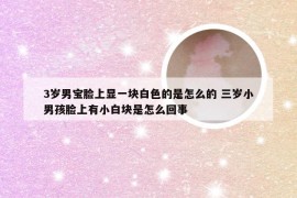 3岁男宝脸上显一块白色的是怎么的 三岁小男孩脸上有小白块是怎么回事