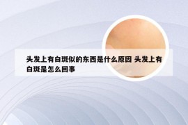 头发上有白斑似的东西是什么原因 头发上有白斑是怎么回事