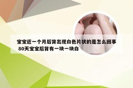 宝宝近一个月后背出现白色片状的是怎么回事 80天宝宝后背有一块一块白