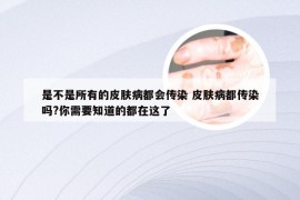 是不是所有的皮肤病都会传染 皮肤病都传染吗?你需要知道的都在这了