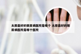太原最好的银屑病医院是哪个 太原最好的银屑病医院是哪个医院