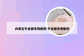 内蒙古牛皮癣生物制剂 牛皮癣生物制药