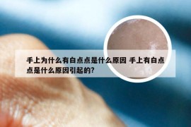 手上为什么有白点点是什么原因 手上有白点点是什么原因引起的?