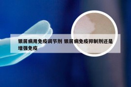 银屑病用免疫调节剂 银屑病免疫抑制剂还是增强免疫