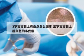 3岁宝宝腿上有白点怎么回事 三岁宝宝腿上起白色的小疙瘩