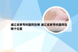 通辽皮肤专科医院在哪 通辽皮肤专科医院在哪个位置