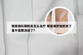 银屑病长期脱皮怎么治疗 银屑病开始脱皮了是不是要消退了?