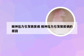 精神压力引发银屑病 精神压力引发银屑病的原因