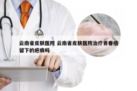 云南省皮肤医院 云南省皮肤医院治疗青春痘留下的疤痕吗