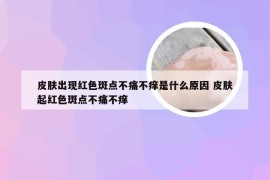 皮肤出现红色斑点不痛不痒是什么原因 皮肤起红色斑点不痛不痒