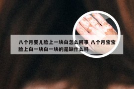 八个月婴儿脸上一块白怎么回事 八个月宝宝脸上白一块白一块的是缺什么吗