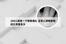 200人就有一个银屑病么 正常人得银屑病的几率是多少
