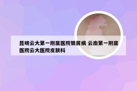 昆明云大第一附属医院银屑病 云南第一附属医院云大医院皮肤科