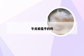 牛皮癣是平的吗