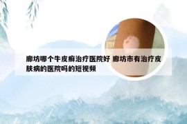 廊坊哪个牛皮癣治疗医院好 廊坊市有治疗皮肤病的医院吗的短视频