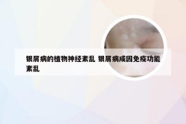 银屑病的植物神经紊乱 银屑病成因免疫功能紊乱