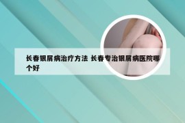 长春银屑病治疗方法 长春专治银屑病医院哪个好