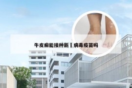 牛皮癣能接种新冦病毒疫苗吗