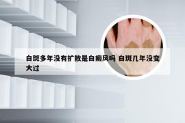 白斑多年没有扩散是白癜风吗 白斑几年没变大过