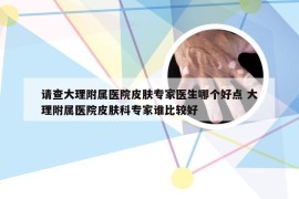 请查大理附属医院皮肤专家医生哪个好点 大理附属医院皮肤科专家谁比较好
