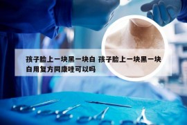 孩子脸上一块黑一块白 孩子脸上一块黑一块白用复方同康唑可以吗