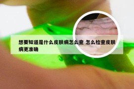 想要知道是什么皮肤病怎么查 怎么检查皮肤病更准确