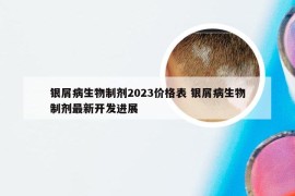 银屑病生物制剂2023价格表 银屑病生物制剂最新开发进展