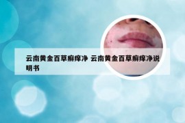 云南黄金百草癣痒净 云南黄金百草癣痒净说明书