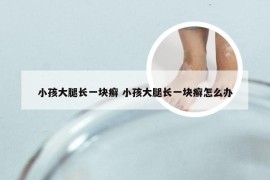 小孩大腿长一块癣 小孩大腿长一块癣怎么办