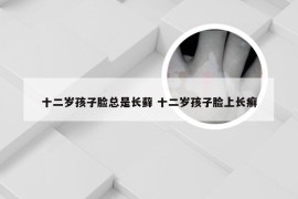 十二岁孩子脸总是长藓 十二岁孩子脸上长癣