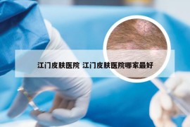 江门皮肤医院 江门皮肤医院哪家最好