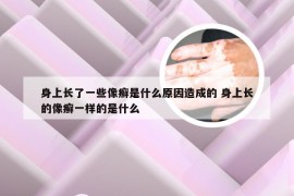 身上长了一些像癣是什么原因造成的 身上长的像癣一样的是什么