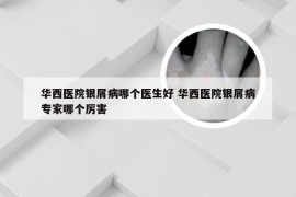 华西医院银屑病哪个医生好 华西医院银屑病专家哪个厉害