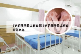 5岁的孩子脸上有白斑 5岁的孩子脸上有白斑怎么办
