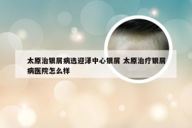 太原治银屑病选迎泽中心银屑 太原治疗银屑病医院怎么样