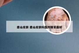 唐山皮肤 唐山皮肤科医院哪家最好