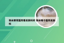 衡水那家医院看皮肤科好 衡水哪个医院皮肤科
