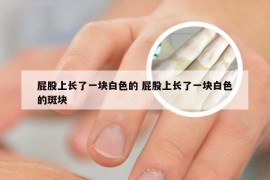 屁股上长了一块白色的 屁股上长了一块白色的斑块