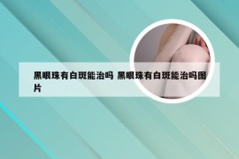 黑眼珠有白斑能治吗 黑眼珠有白斑能治吗图片