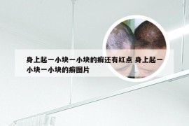 身上起一小块一小块的癣还有红点 身上起一小块一小块的癣图片