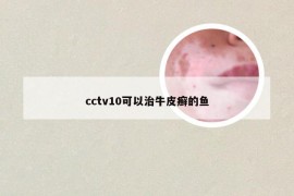 cctv10可以治牛皮癣的鱼