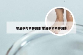 银屑病与精神因素 银屑病和精神因素