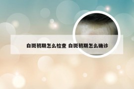 白斑初期怎么检查 白斑初期怎么确诊